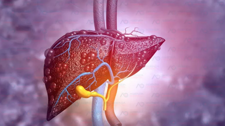 Hepatitis C, una infección que puede curarse en más del 95% de los casos